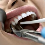 Dentitox pro review