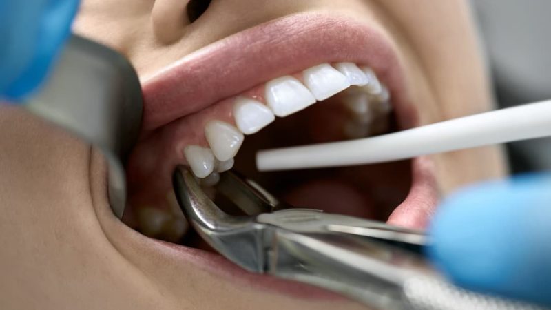 How to use dentitox to improve your dental care