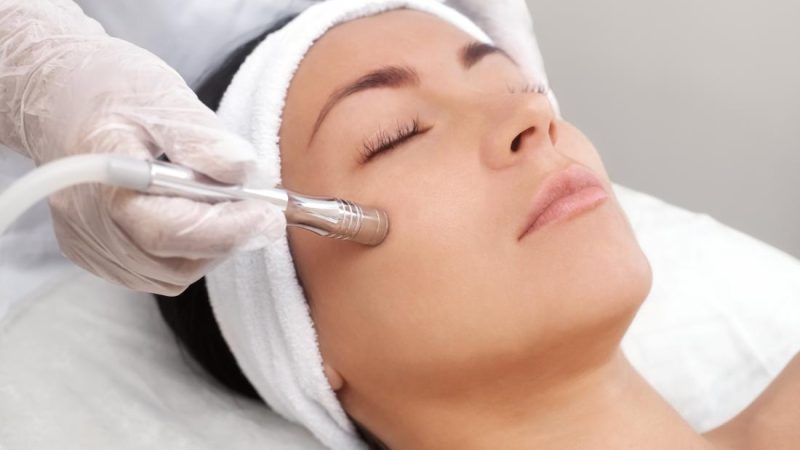 How to Choose the Right Professional for Your Microdermabrasion Treatment